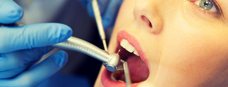 Wurzelbehandlung Zahn Offen Watte